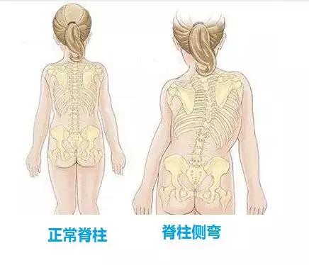 久坐會造成脊柱問題，影響兒童成長