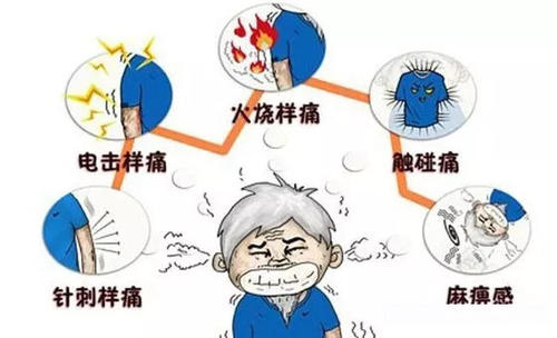 專家教你科學(xué)防治帶狀皰疹 小小水泡為何讓人痛不欲生？