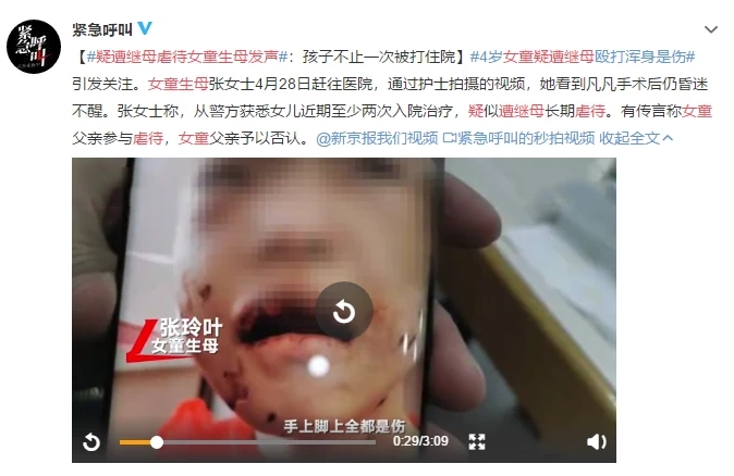 4歲女童疑遭繼母毆打重傷進(jìn)ICU：虐童案頻發(fā)，除了憤怒我們更應(yīng)該站出來(lái)