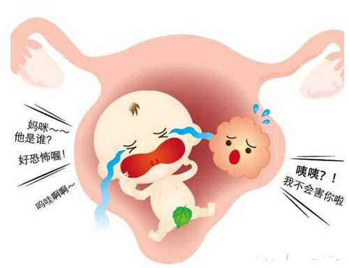 這種瘤20%的女性都會長 常見癥狀有哪些？