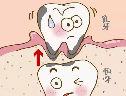 別讓蛀牙害了孩子！這些事 父母再不做就晚了