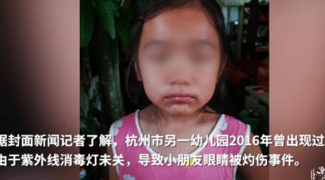 杭州小學(xué)誤開紫外線燈灼傷學(xué)生眼睛 官方：電工操作失誤