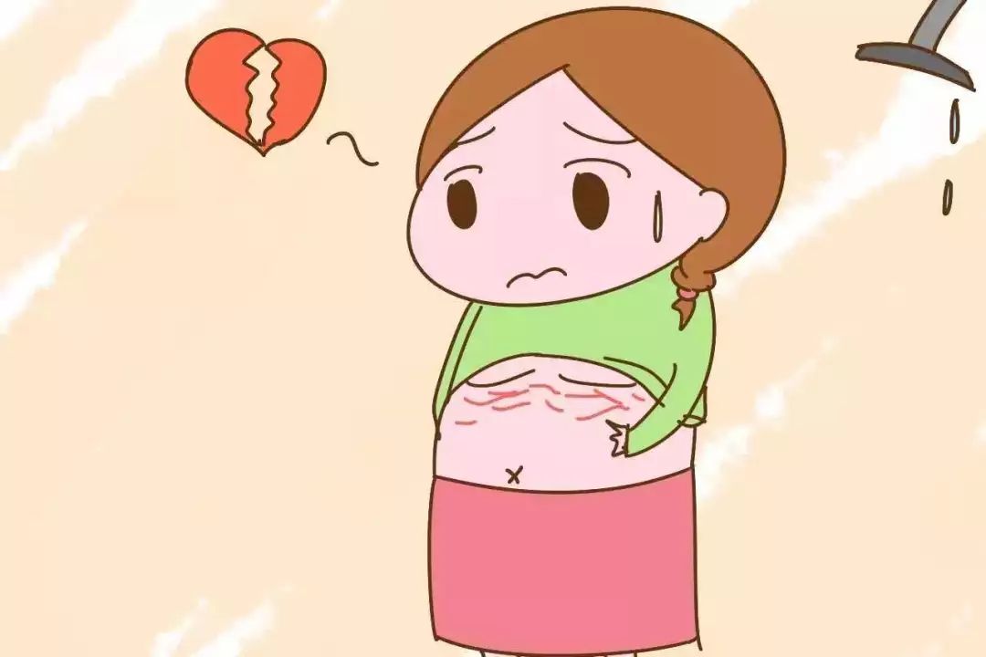 令人煩惱的妊娠紋，怎么才能預(yù)防呢？
