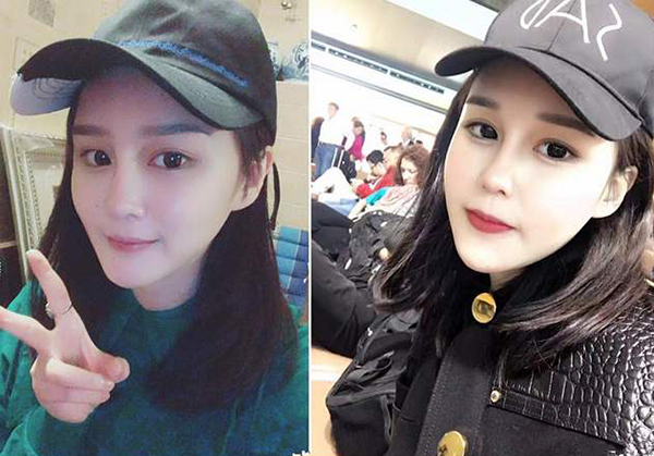 趙本山女兒撞臉李小璐？竟花30萬做鼻子！