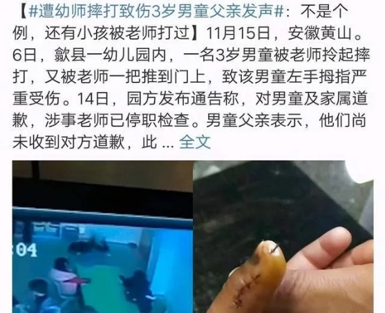 得知孩子被虐待，寶爸怒打幼師，園方袒護(hù)老師不道歉不讓報(bào)警