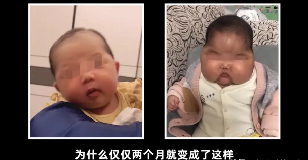“大頭娃娃”重現(xiàn)，原因竟然是嬰兒霜激素超標