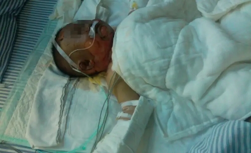 眼見孫女掉進(jìn)熱水鍋，奶奶卻還抱著孫子不撒手，重男輕女害人不淺