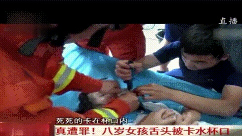 來自喝水杯的惡意，8歲女孩舌頭被水杯口卡住，險被夾斷