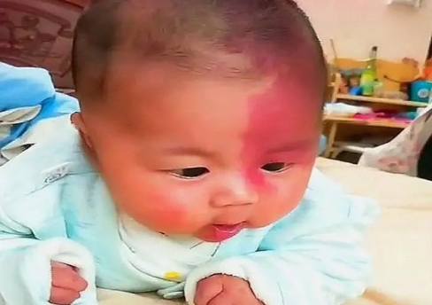 為了避免新生兒有胎記，孕期準媽媽最好避開這3種行為