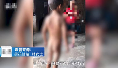 因偷拿餅干，廣東男童被房主綁在樹上用高溫鍋勺燙傷！