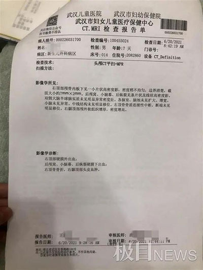 痛心！出生6天寶寶被月嫂摔成顱骨骨折