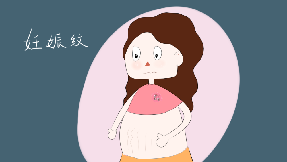 孕婦避免妊娠紋要從平時的保養(yǎng)開始