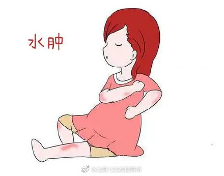 孕期生理性水腫和病理性水腫怎么區(qū)分？