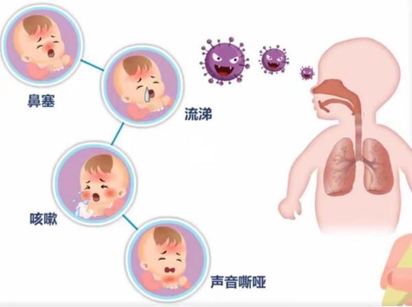 反復(fù)低燒、咳嗽……警惕呼吸道合胞病毒！專家：重點關(guān)注嬰幼兒