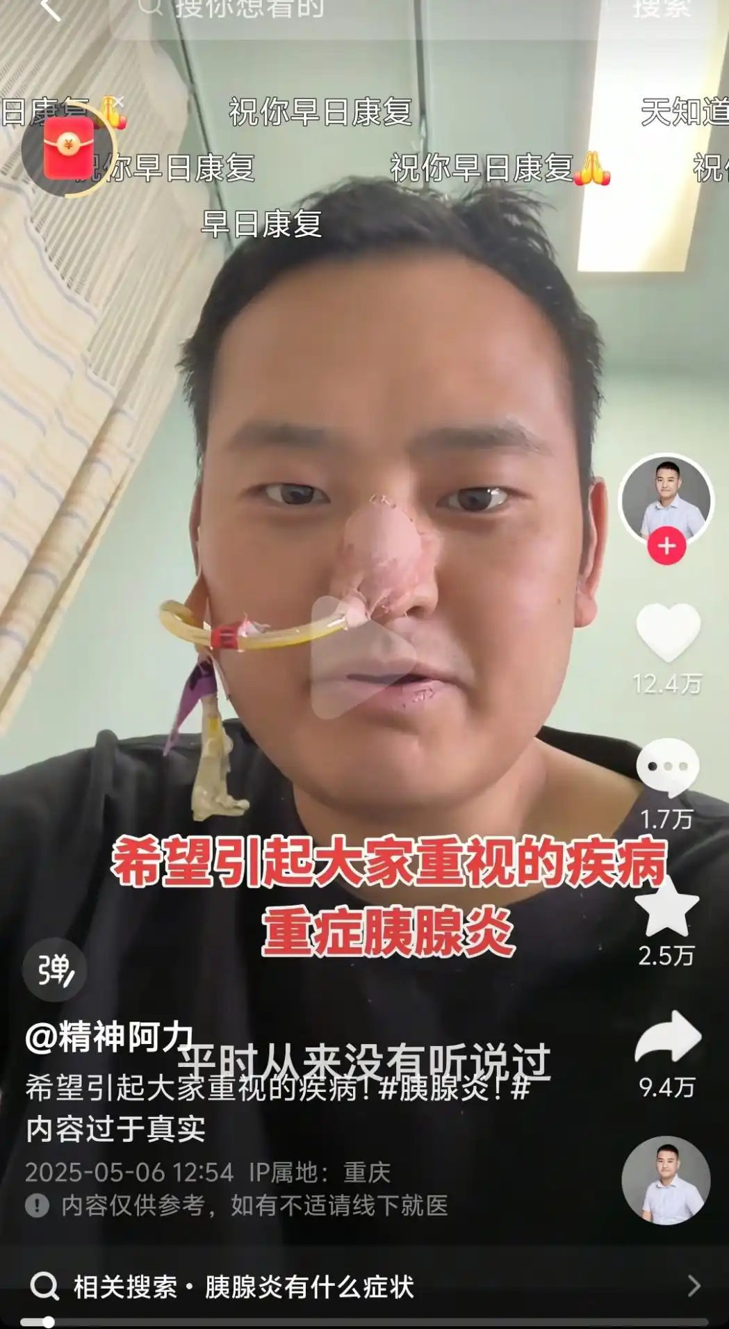 放縱飲食，須警惕“重癥急性胰腺炎”這個健康殺手